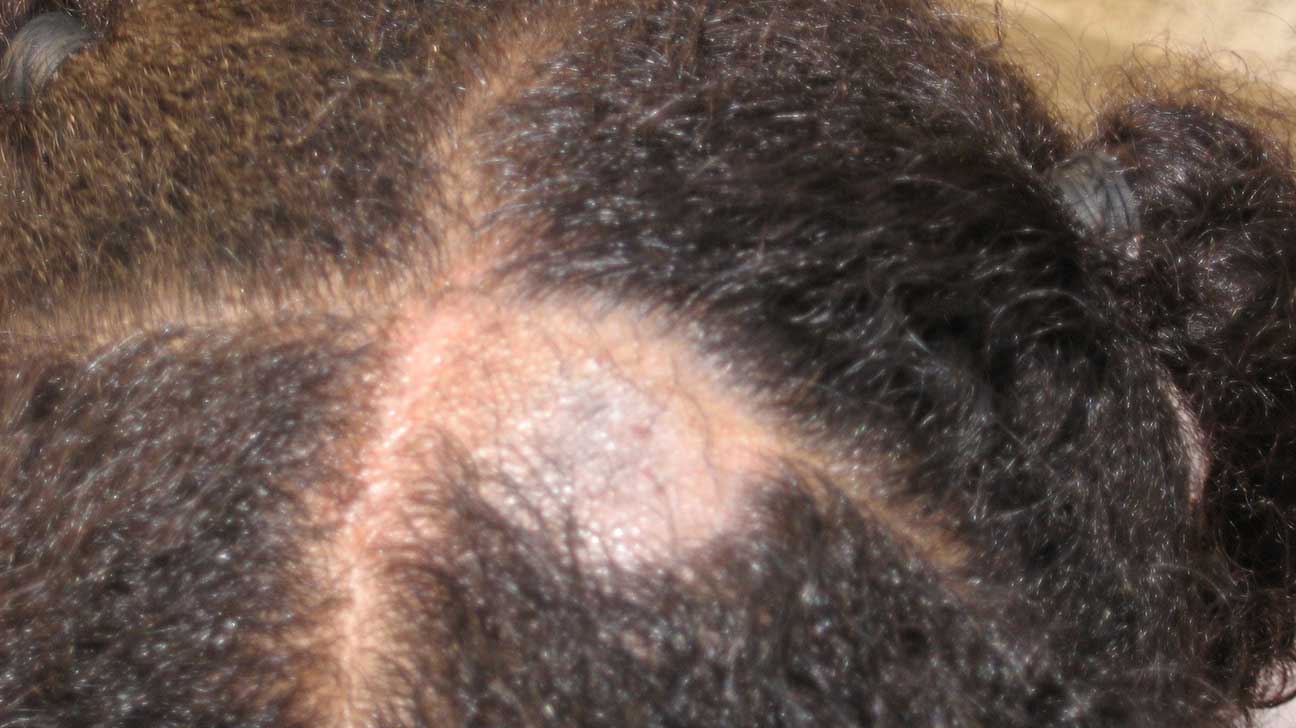 skin scalp condition